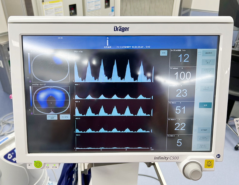 EIT（Electrical Impedance Tomography）